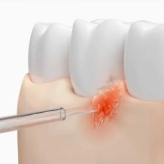 دستگاه شست و شوی دهان و دندان شیائومی مدل Water Flosser 2 - سفید